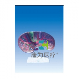 “康為醫(yī)療”肝膽解剖、甘血管、膽管的肝分布